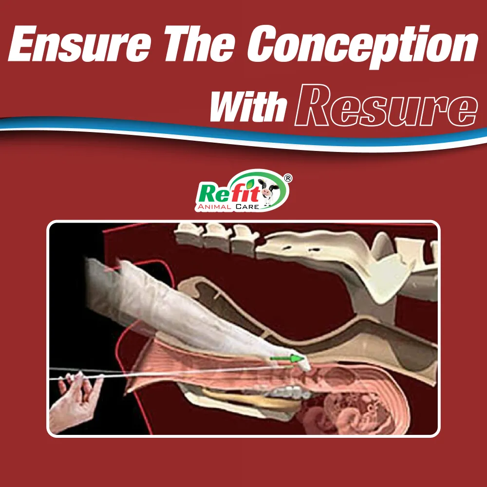 resure whychoose.webp